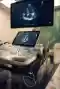 myocardial strain imaging
